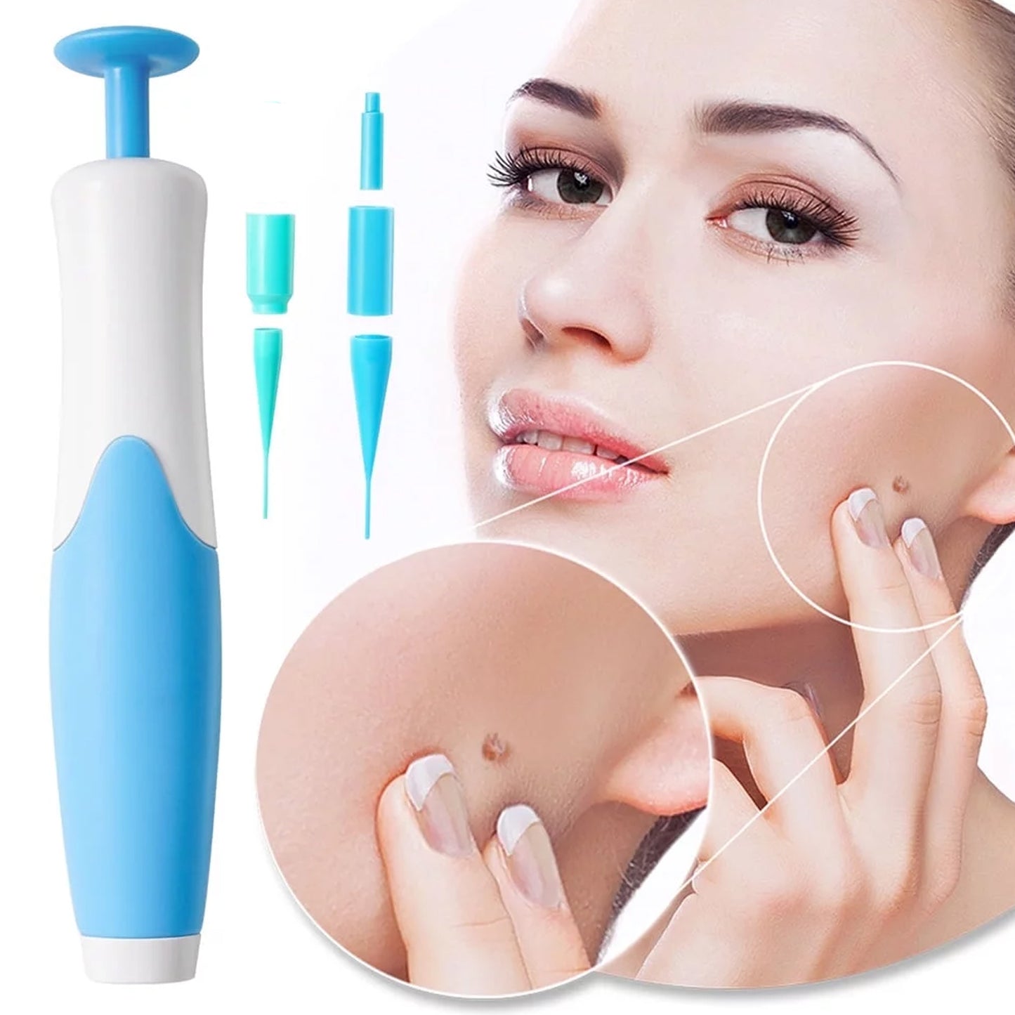 Skin Tag Remover Kit 2-in-1 (2 mm – 8 mm)